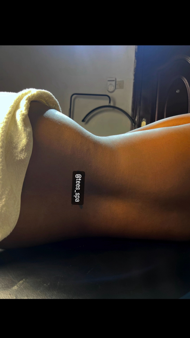 Waist Line Reduction